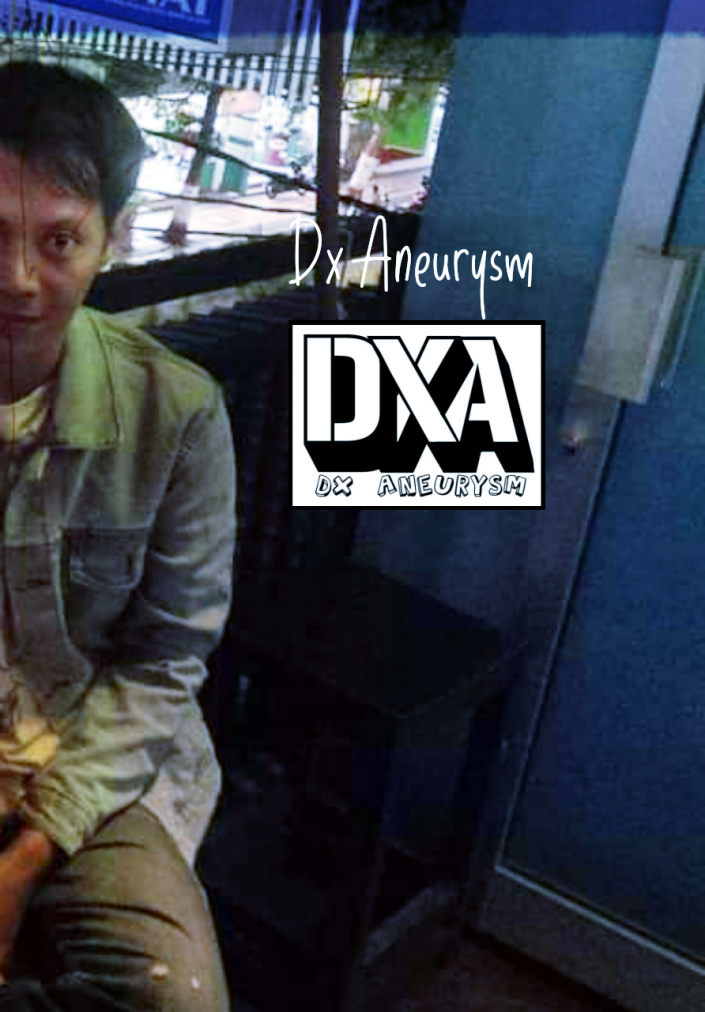 Dx Aneurysm