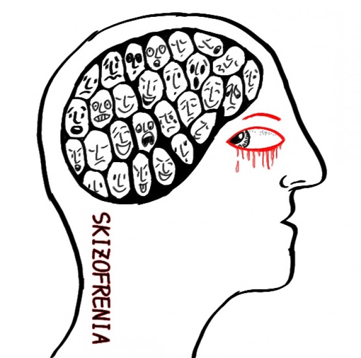 Skizofrenia